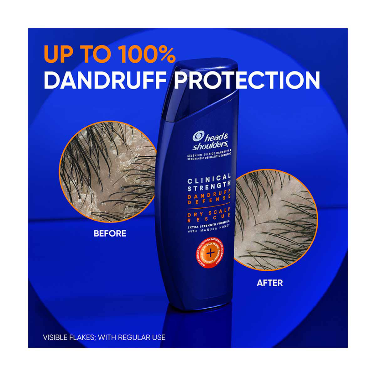 Head & Shoulders Clinical Strength Dandruff Defense